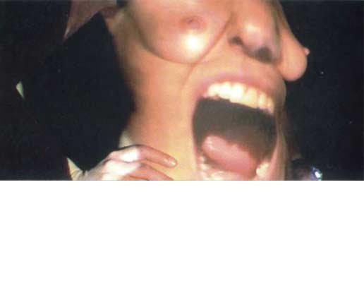 Operation Sch&ouml;nheit